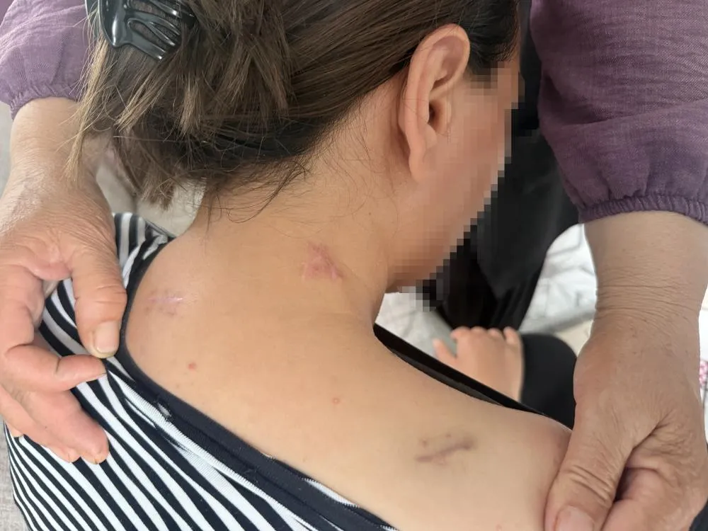 17 Bıçak Darbesiyle Yere Yığıldı, Ölü Taklidi Yaparak Kurtuldu